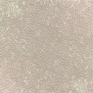 人臍帶間充質干細胞 Human umbilical cord mesenchymal stem cells